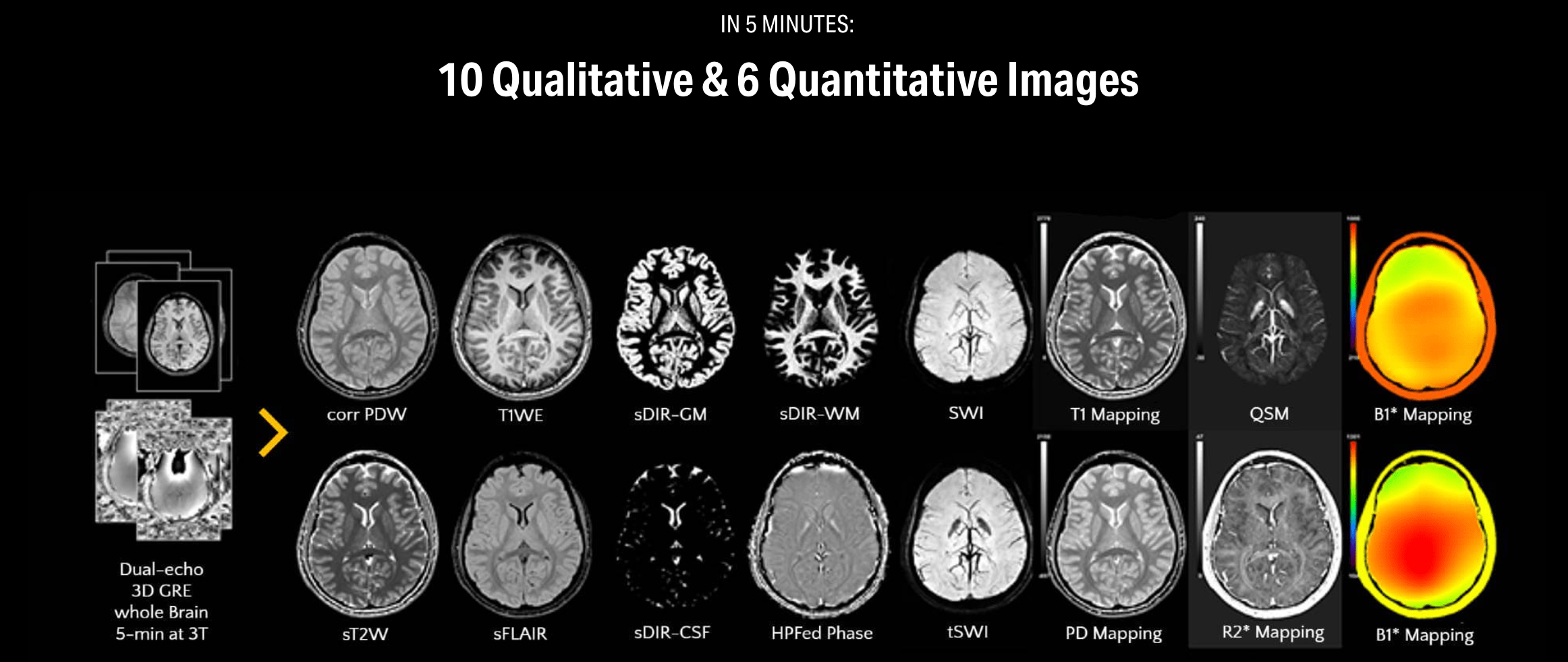 US FDA Clears SpinTech MRI Quantitative Brain Imaging Technology